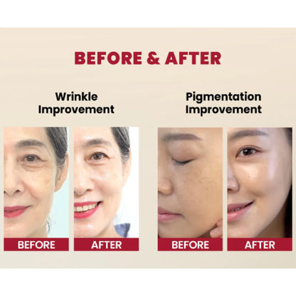 KSECRET - SEOUL 1988 Serum : Retinal Liposome 2% + Black Ginseng
