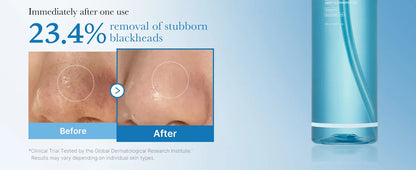 MEDICUBE - ZERO PORE BLACKHEAD DEEP CLEANSING OIL 205ml
