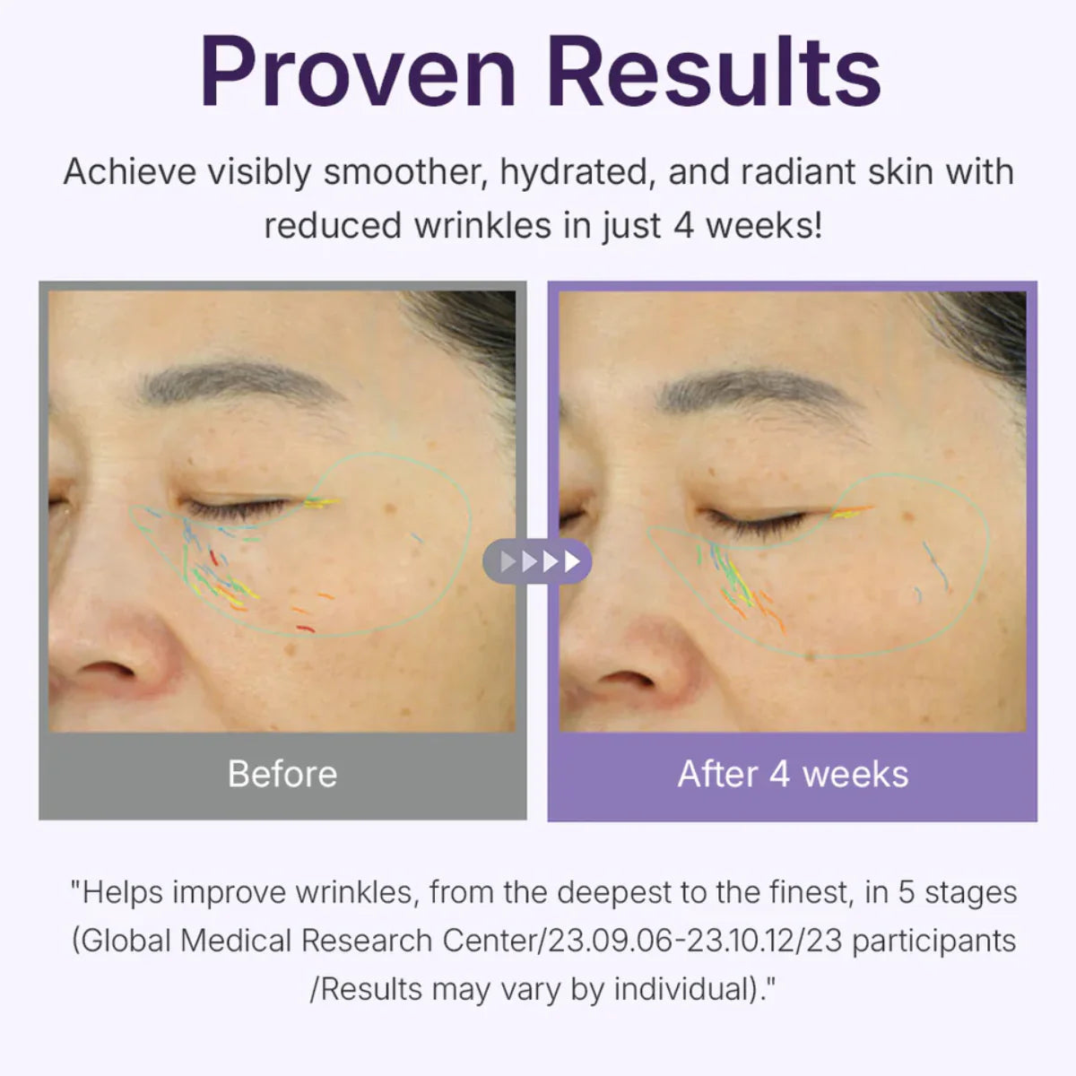 CENTELLIAN24 - 360º Shot PDRN Active Serum 50ml