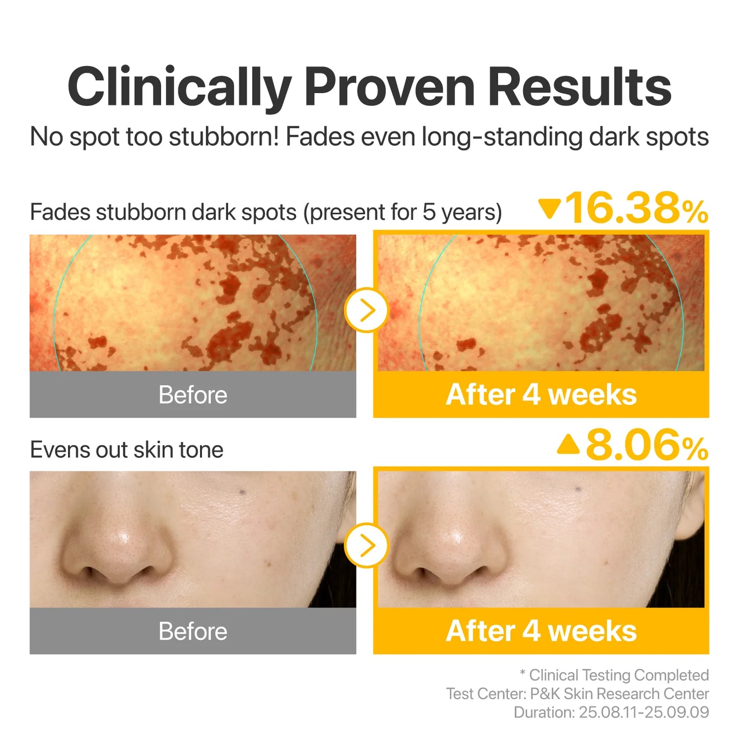 NUMBUZIN - No.5 Glutathione TXA Advanced Dark Spot Ampoule Concentrate 10g | Ampolla Coreana Antimanchas