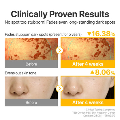 NUMBUZIN - No.5 Glutathione TXA Advanced Dark Spot Ampoule Concentrate 10g | Ampolla Coreana Antimanchas