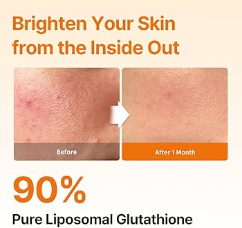 ESTHER FORMULA - Yeo Esther Liposome Glutathione Direct Ultra X | Glutatión Liposomal en Láminas | 30 Sheets