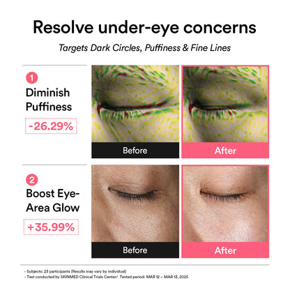 ABIB - PDRN RETINAL EYE PATCH GLOW JELLY 84g, 30pairs