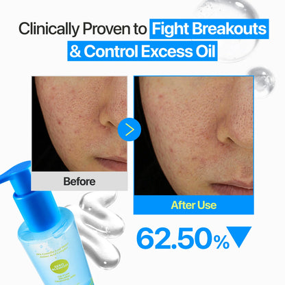 NUMBUZIN - No.0 Oil-Free Micellar Cleansing Jelly 200ml