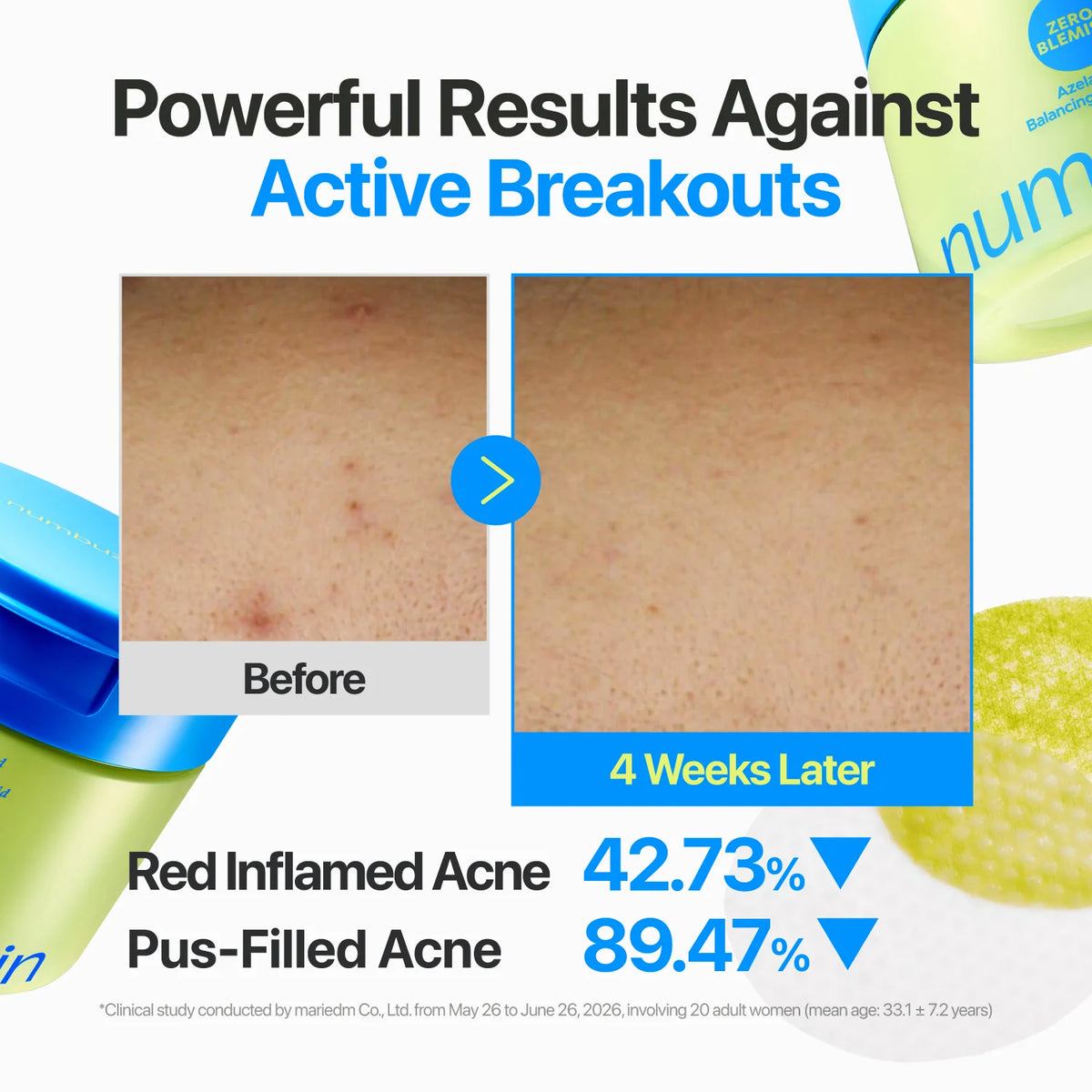 NUMBUZIN - Zero Blemish Azela Cica Balancing Dual Pads 210ml (60Pads)