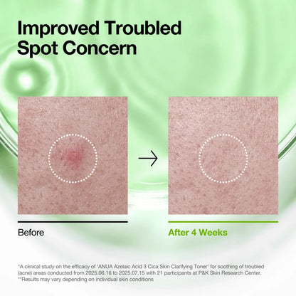 ANUA - AZELAIC ACID 3 CICA SKIN CLARIFYING TONER 250ml