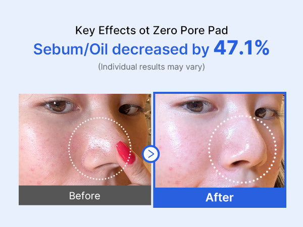 MEDICUBE - TONER PADS ZERO PORE PAD 2.0 (70pcs)