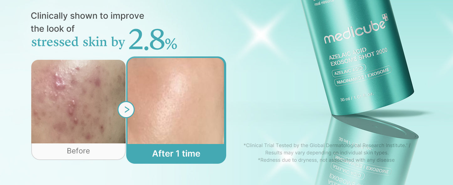 MEDICUBE - AZELAIC ACID EXOSOME SHOT 2000 30ml